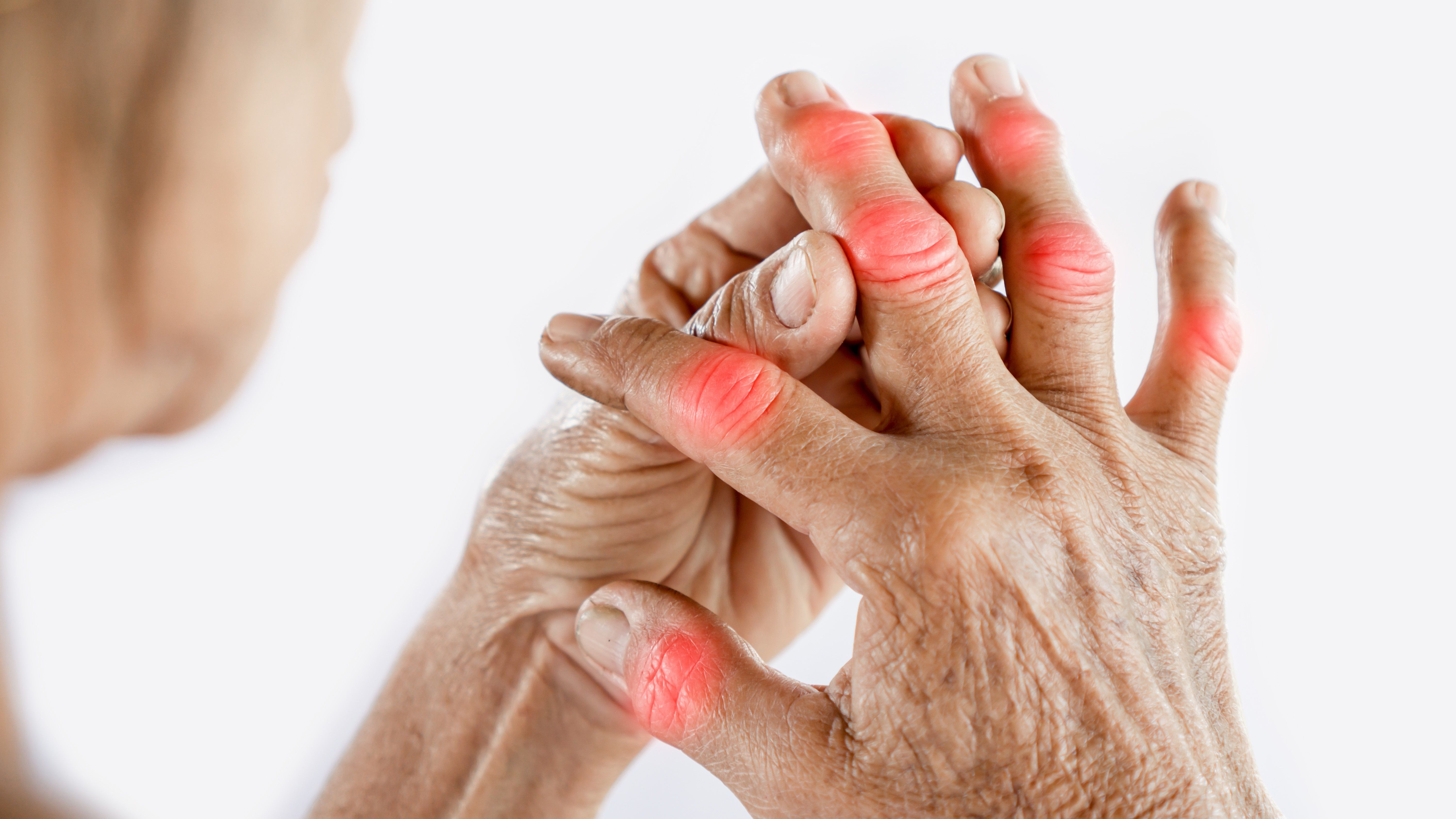 Hand & Finger Fracture