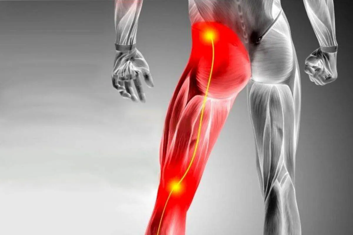 Hip Fracture