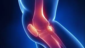 Hip Fracture